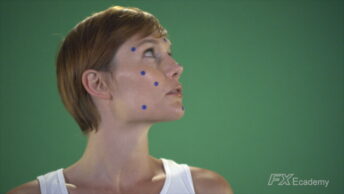 Marker Removal 02